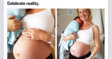 Galerie foto. Mitul perfecțiunii, demontat. BURTA DUPĂ SARCINĂ / Imaginile reale și needitate ale unei proaspete mămici - 3