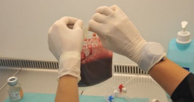 Stire din Cetățenești : Când se recoltează celulele stem