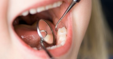 Stire din Sănătate : Academia  de Zâmbete a susținut un curs de sănătate oro - dentară la Eforie