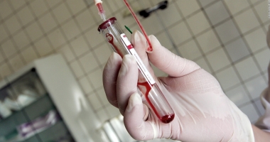 Stire din Sănătate : Cutremurător. Cinci pacienți au fost infectați cu HIV prin refolosirea echipamentului