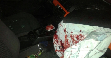 ACCIDENT GRAV CU CINCI VICTIME, ÎN URMA UNEI CURSE DE MAȘINI, LA MEDGIDIA. Galerie foto - 16
