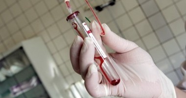 Stire din Sănătate : Bolnavii de hepatită și hemofilie, fără tratament