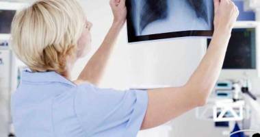 Stire din Sănătate : Investigații pentru depistarea cancerului pulmonar, la MEDSTAR 2000