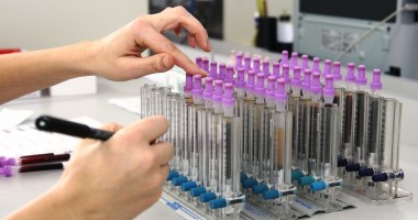 Stire din Sănătate : OFERTA unui spital din CONSTANȚA / Consultație și analize medicale la jumătate de preț, la medicul hematolog