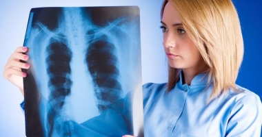 Nefumătorii prezintă risc foarte scăzut de cancer pulmonar