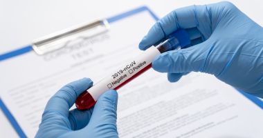 Stire din Social : Câte teste pentru coronavirus au fost efectuate până acum în România