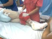 Pacienta cu răni până la os, de la Băneasa, a murit