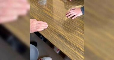 ATENŢIE, IMAGINI CU IMPACT EMOŢIONAL! "Moneda rusească", joc periculos printre elevi. Medic: "Infecția poate să ajungă la nivelul oaselor" - 3