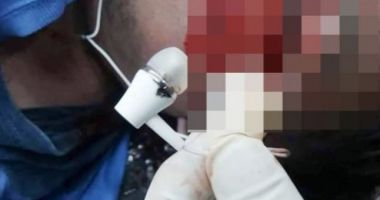 Un adolescent de 16 ani a murit electrocutat, după ce a adormit cu căștile telefonului în urechi