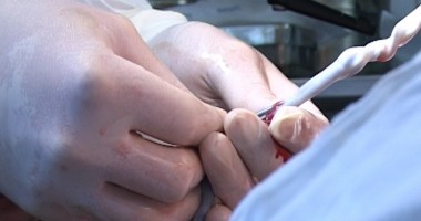 Momentul corect al recoltării celulelor stem