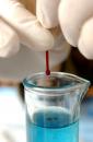 Stire din Sănătate : Diabeticii plătesc analizele medicale care ar trebui să fie gratuite