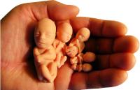Stire din Sănătate : Pastila pentru avort, nerecomandată de medicii ginecologi