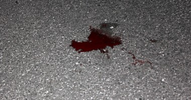 Bărbat rănit grav de un autobuz pe trecerea de pietoni - 3