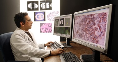 Stire din Sănătate : Accidentul  vascular  cerebral, introdus pe lista handicapurilor