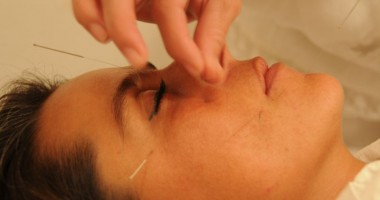 Stire din Sănătate : Acupunctura, terapia lui Ying și Yang
