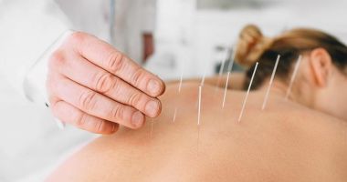 Stire din Sănătate : Efectele acupuncturii pentru organism se simt după cel puțin cinci ședințe