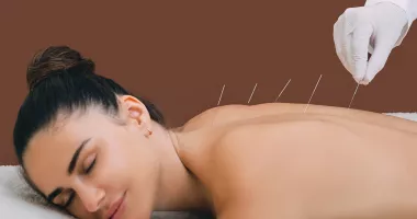 Stire din Sănătate : Acupunctura dă rezultate vizibile încă de la primele ședințe