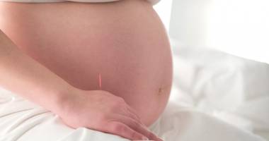 Stire din Sănătate : Acupunctura  în timpul sarcinii.  Riscantă sau benefică?