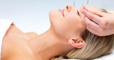 Acupunctura - terapia care vă scapă de dureri