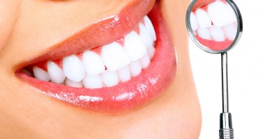 Ce trebuie să știi despre albirea dentară - 2