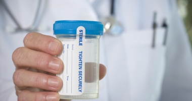 Stire din Sănătate : O simplă analiză de urină poate fi salvatoare