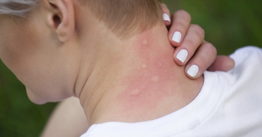 Stire din Sănătate : Aveți grijă ce haine folosiți. Alergiile la textile sunt extrem de deranjante