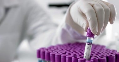 Stire din Sănătate : 7.000 de pacienți testați pentru HIV  și hepatită de Fundația Baylor