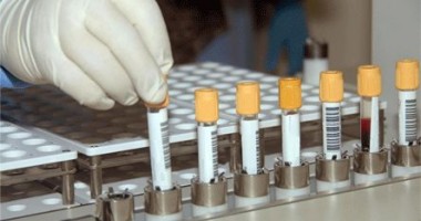 Stire din Sănătate : Trei cazuri de TBC la un liceu din Hârșova!