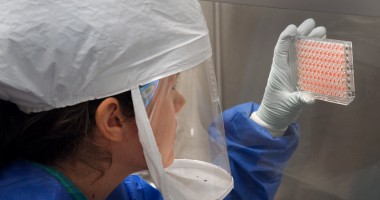 Stire din Actualitate : Veste bună! Un nou tip de anticorp împotriva virusului Ebola
