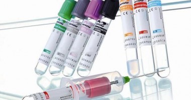 Stire din Sănătate : Metodă revoluționară în tratarea diabetului