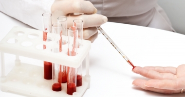 S-a descoperit un test de sânge care ar putea preveni infarctul