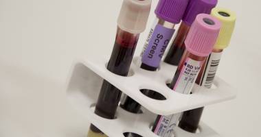 Stire din Sănătate : Angajații Gărzii de Coastă, testați pentru hepatită
