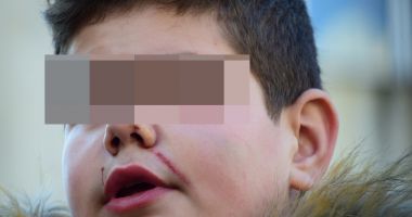 Stire din Eveniment : Scandal la Școala nr. 28. Femeile care au agresat  un elev, arestate la domiciliu