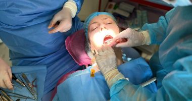 Implantul subperiostal, realizat cu succes la M&M Dental Team din Constanţa - 7