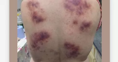 Stire din Eveniment : Curaj pedepsit cu pumnii. A sărit în ajutor și a fost lovită crunt