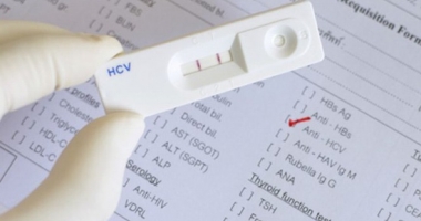 Stire din Sănătate : Ce trebuie să știe pacienții care încep tratamentul împotriva Hepatitei C
