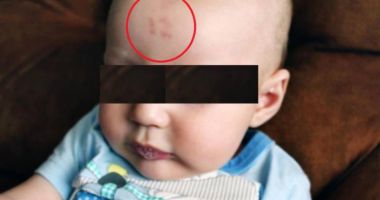 Stire din Actualitate : Medicii, uimiţi de semnul care i-a apărut unui bebeluş pe frunte, după naştere