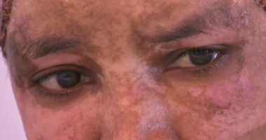 Stire din Actualitate : Imagini șocante: Bona copiilor unuia dintre fiii lui Gaddafi, mutilată de soția acestuia VIDEO
