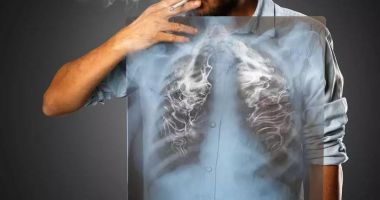 Stire din Sănătate : Beatrice Mahler: 694 de cazuri de cancer pulmonar diagnosticate în primele şase luni ale anului - peste 61% cu metastaze