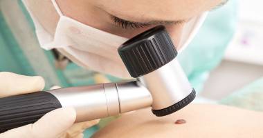 Stire din Sănătate : Cancerul de piele poate fi mutilant