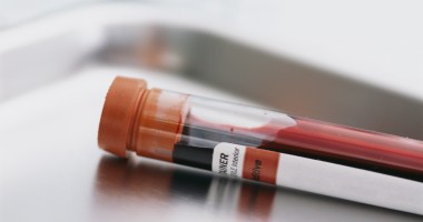 Stire din Sănătate : Cancerul ovarian, depistat printr-un test de sânge