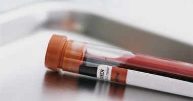 Stire din Sănătate : Centru de diagnosticare și monitorizare a cancerului la copii, deschis la Constanța