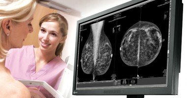 Stire din Sănătate : 6.000 de românce, diagnosticate cu cancer mamar în 2011