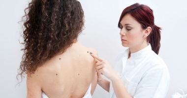 Stire din Sănătate : Ce este cancerul de piele și cum poate fi prevenită apariția acestuia
