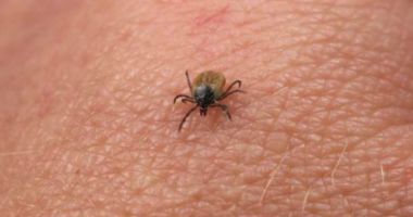 Stire din Social : Mai multe persoane s-au prezentat la spital din cauza înțepăturilor de căpușe