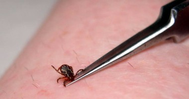 Stire din Sănătate : Cât de periculoase sunt mușcăturile de căpușă