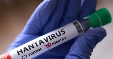 Stire din Social : Opt contacți ai pacientului cu hantavirus din Arad, izolați și monitorizați timp de 21 de zile