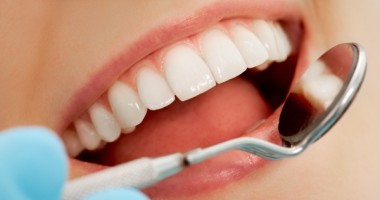 Stire din Sănătate : Cum vom putea preveni cariile dentare