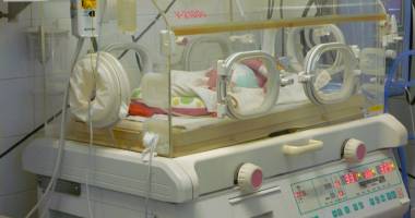 Stire din Sănătate : Caz incredibil:  fetițe siameze născute  în maternitatea Constanța
