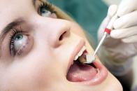 Românii, codași la vizitele la dentist